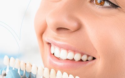 Safe, Effective Teeth Whitening Options